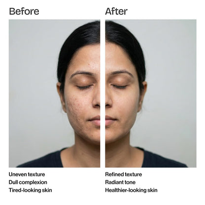 Cell Regenerating Moisturizer with Hyaluronic Acid & Ceramide Complex for Hydrated, Bright & Healthy Looking Skin – 50 ml