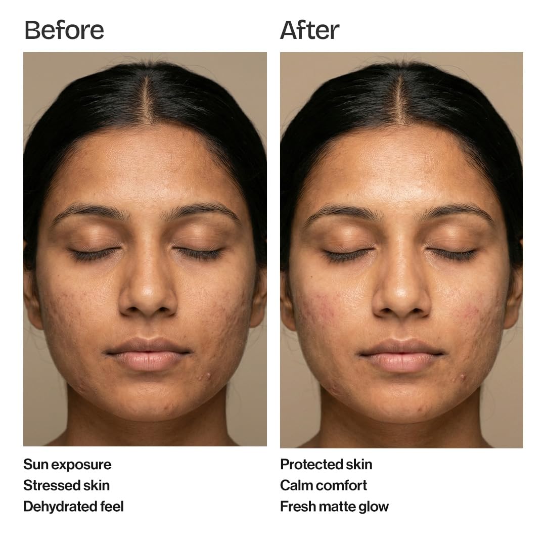 post sun derma shield sunscreen spf 50 pa++++ with hyaluronic complex & vitamin e – 50 ml