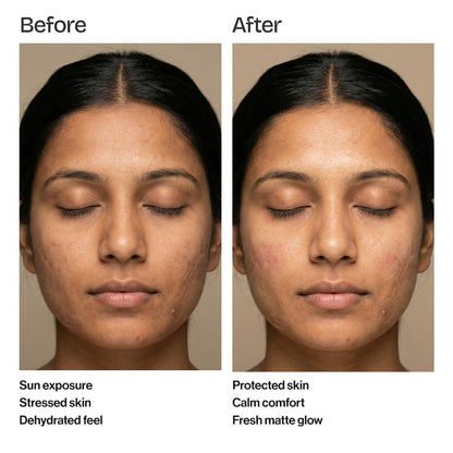 Post Sun Derma Shield Sunscreen SPF 50 PA++++ with Hyaluronic Complex & Vitamin E – 50 ml