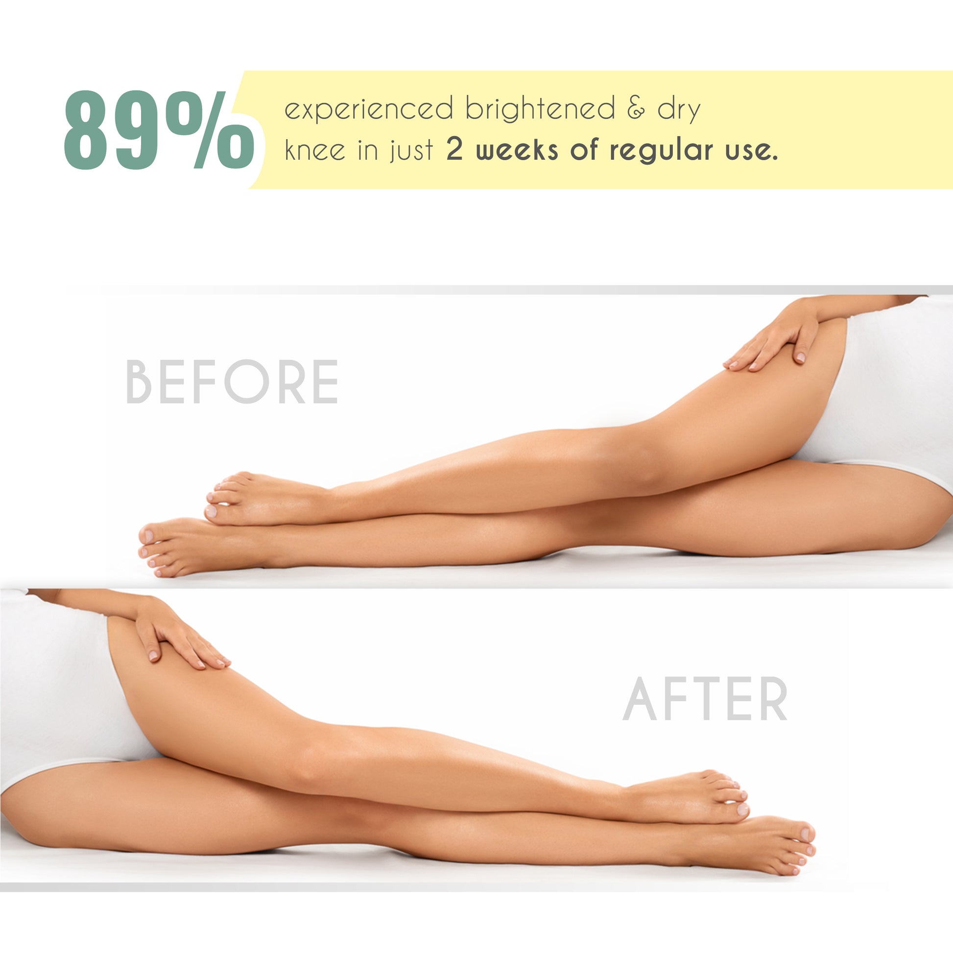 ΞΧ-ΕΜΟΤΙΟΝS  Even Fix Cream – For Dark & Hard Skin on Nape, Elbows, Knees, Knuckles & Back – 100 gm