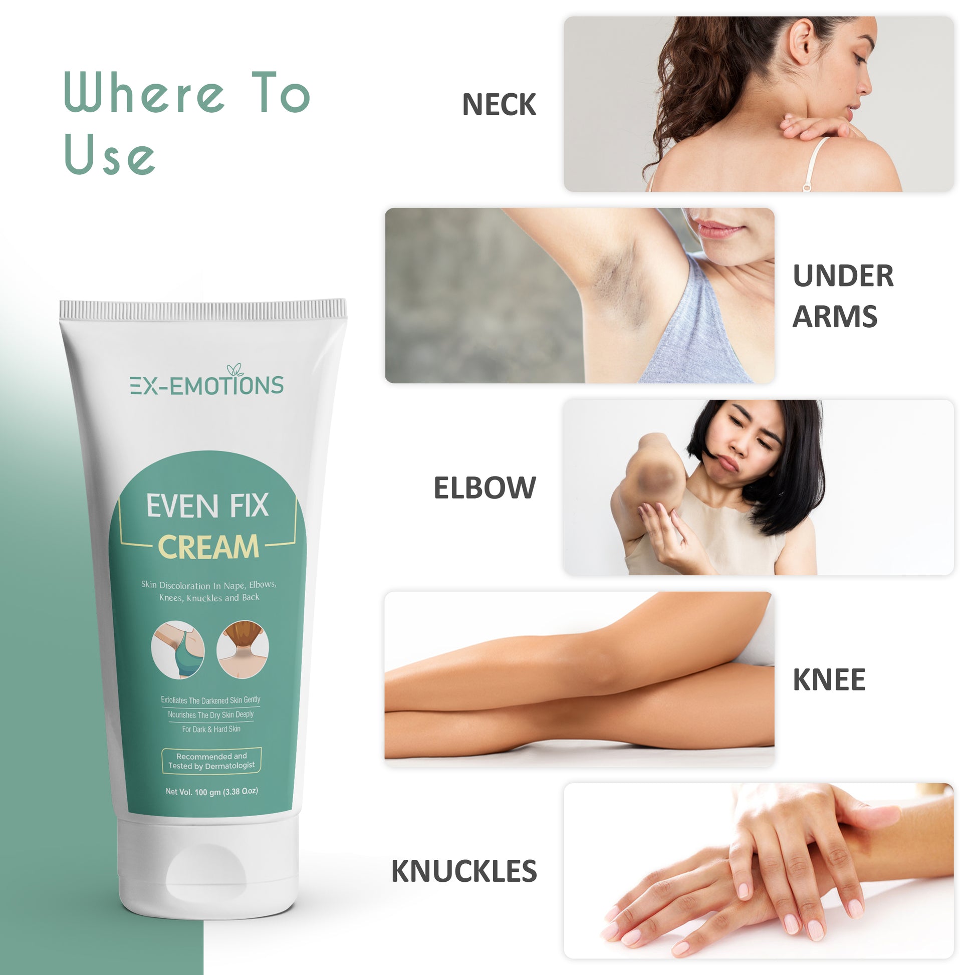 ΞΧ-ΕΜΟΤΙΟΝS  Even Fix Cream – For Dark & Hard Skin on Nape, Elbows, Knees, Knuckles & Back – 100 gm