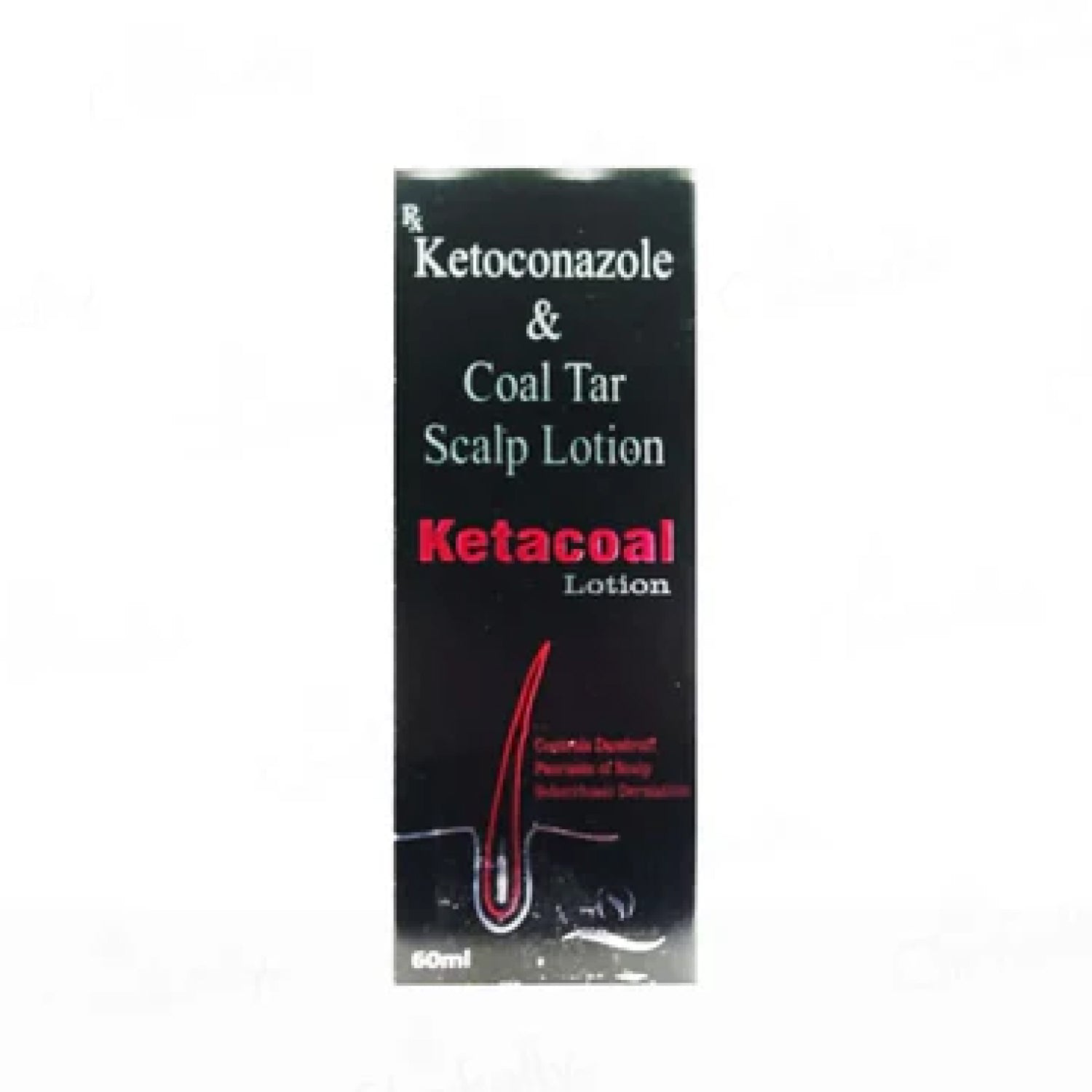 Ketacoal Scalp Lotion – Anti-Dandruff & Psoriasis Treatment with Ketoconazole & Coal Tar | 60ml